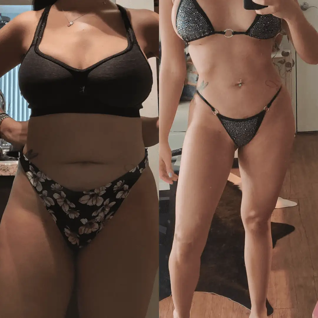 Before and After Image: Liposuction - front