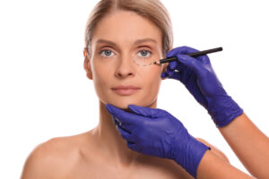 Happy patient having her eyelids drawn on before her blepharoplaty for improved eyelid appearance and vision.